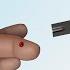 Checking Your Blood Glucose Diabetes Discharge Nucleus Health