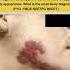 A Tinea Faciei B Lupus Vulgaris C Leprosy D Discoid Lupus Erythematosus