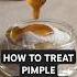 How To Treat Pimples Naturally Pimpletreatment Skincare Naturalskincare