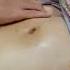 Massage Stomach Pijat Perut