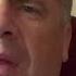 Sanexas Electrical Stimulation For Neuropathy