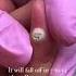 Freezing A Wart
