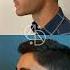1st Year After Rhinoplasty Dr Ahmet Dilber Plasticsurgery Rhinoplastyturkey Rhinoplasty