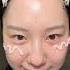 Korean Chok Chok Skin Found It