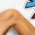 Snapping Hip Syndrome Rehab Education Myths Stretching Strengthening Exercises