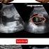 Baby Girl Or Baby Boy How They Appear On Ultrasound 2 3D Shortsfeed Shorts Baby
