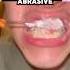 Is This The ULTIMATE Teeth Whitening Routine