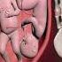 AMAZING TWINS FIGHTING INSIDE THE WOMB FOR SUPREMACY 3D ANIMATION