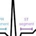 EKG ECG Interpretation Basic Easy And Simple