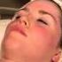 Rena Levi Skin Care Acne Video