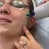 Rosacea Treatment In Santa Monica Dr Kormeili Dermatology 2