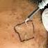 Do Flat Warts Spread Easily Flat Wart Flat Wart Wartremoval Skinaaskincare Viral